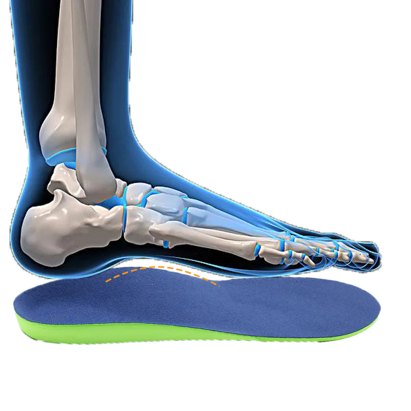 insoles orthotic soles with arch support for stand S-King