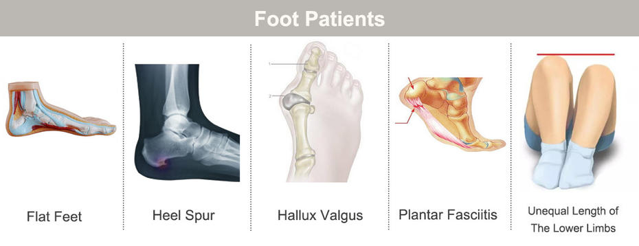 Which kind foot patients need orthopedic insoles