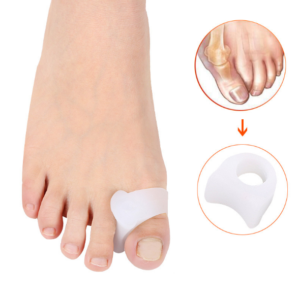 Bunion Corrector Ring and Bunion Relief-Pads for Overlapping Hallux valgus