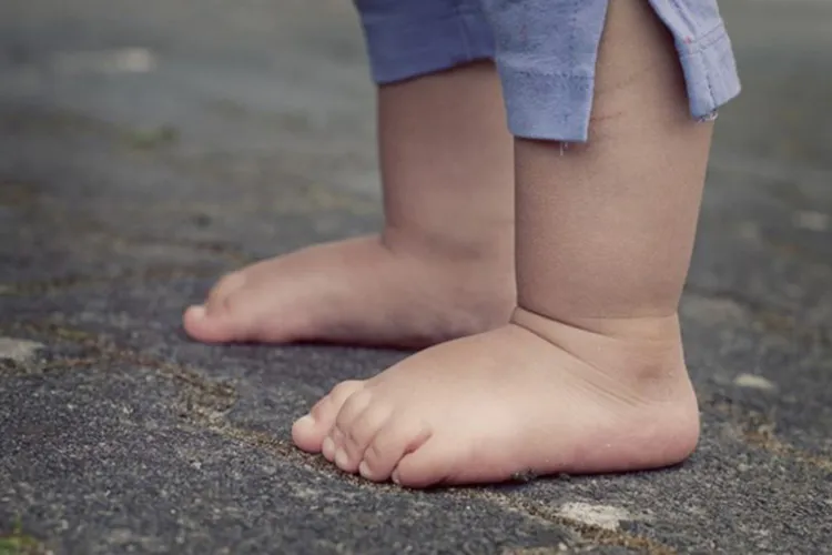 WHAT IS THE CAUSE OF FLAT FEET IN CHILDREN?