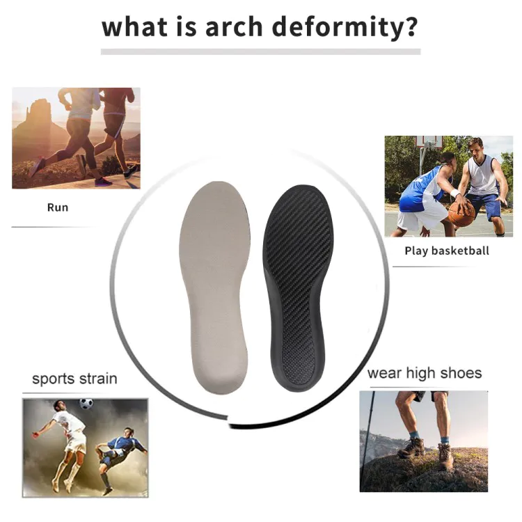 Customized Carbon Fiber Shoes Parts High Stiffness Carbon Fiber Insoles Flatfoot Orthopedic Orthotic Arch Support Insole