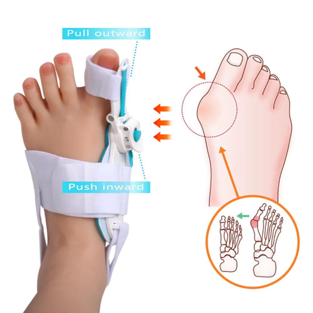 Factory OEM Adjustable Toe Separator Splint Hallux Valgus Orthopedic Toe Bunion Corrector Toe Correction